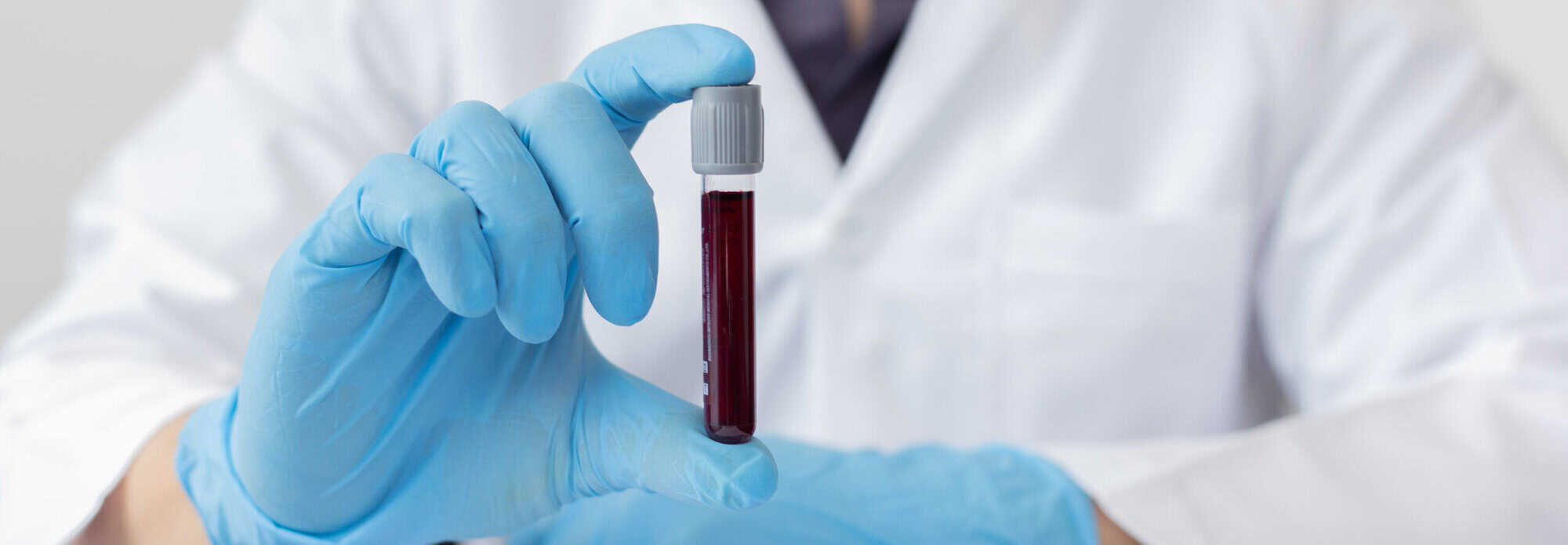 Un nouveau test sanguin approuvé pour diagnostiquer la maladie d ...